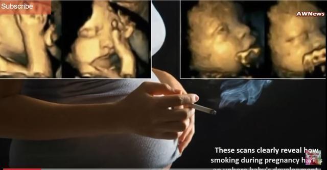 医生提醒：14岁男孩得了高血压，做父母的要知道真相，不要继续伤害他！